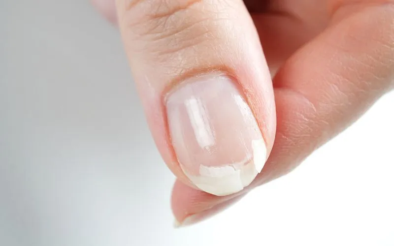 nail sol