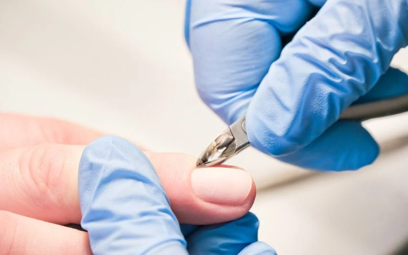Can Cuticle Nippers Cause Infections