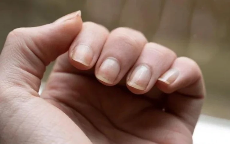 Nails Turning Purple