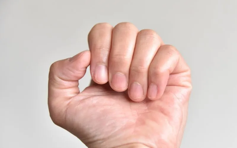 Short Nail Beds